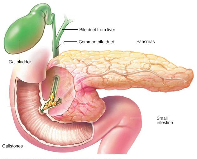 An illustration of a human pancreatitis anatomy