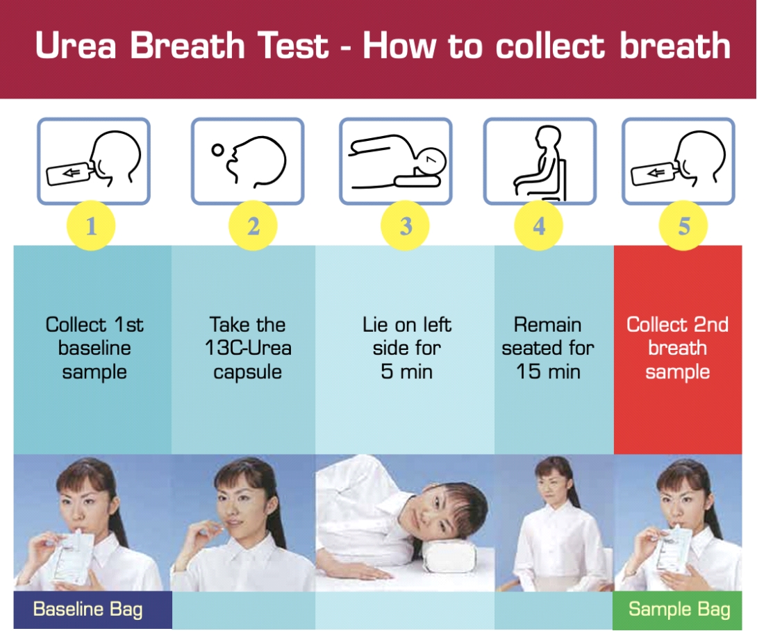 An illustration on how to collect breath for the Urea Breath Test
